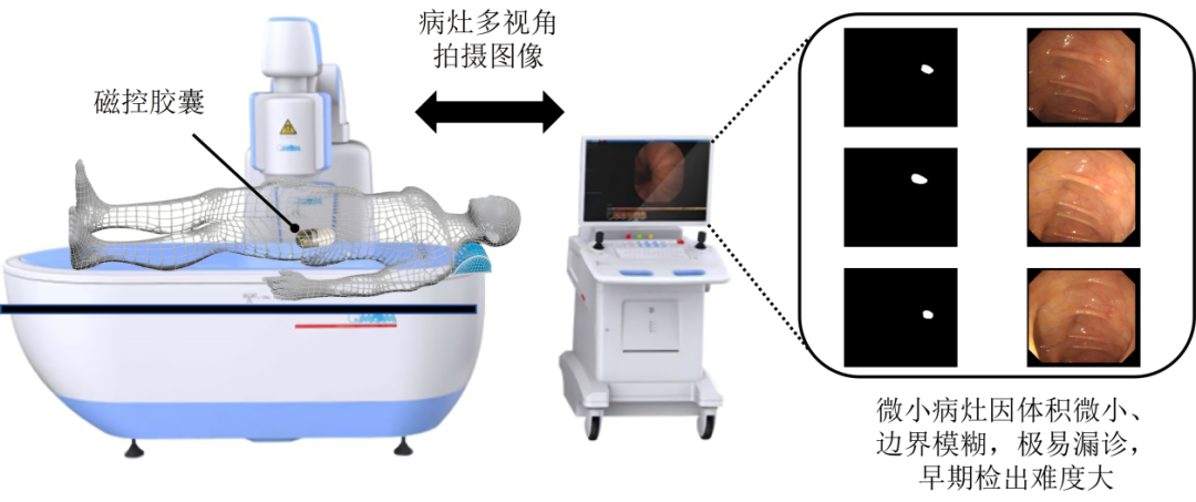 浙江援藏医疗团队聚焦胃肠道疾病 两项课题获批自治区自然科学基金